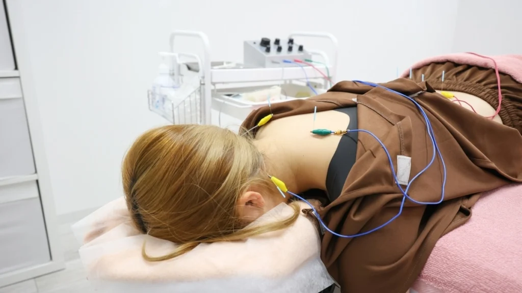 女性が電気鍼（パルス）治療を受けている様子